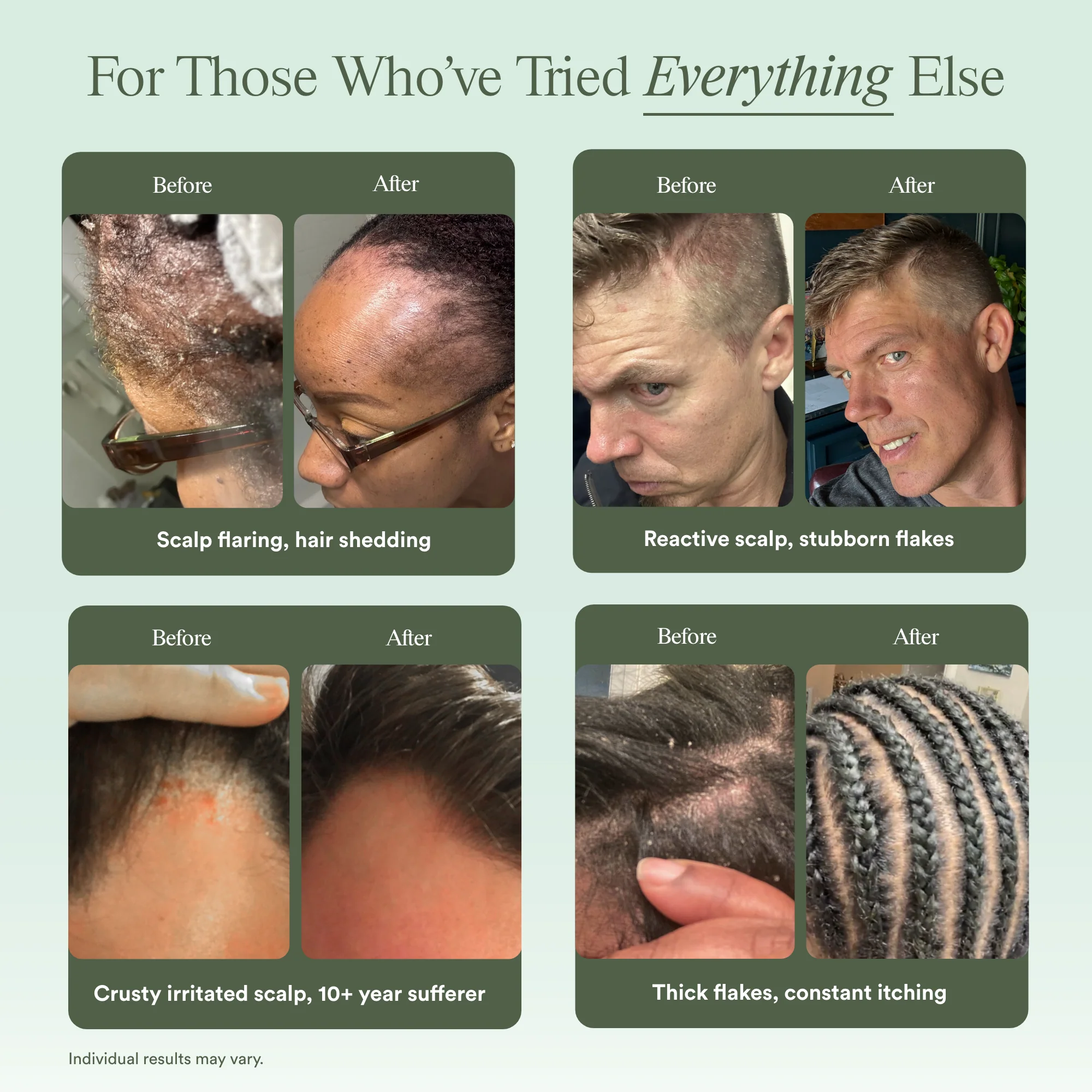Scalp Relief System - Image 5